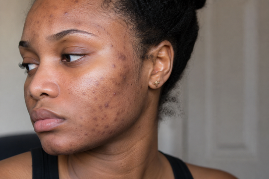 Woman with melanin-rich skin applying brightening body care products to support an even, glowing complexion